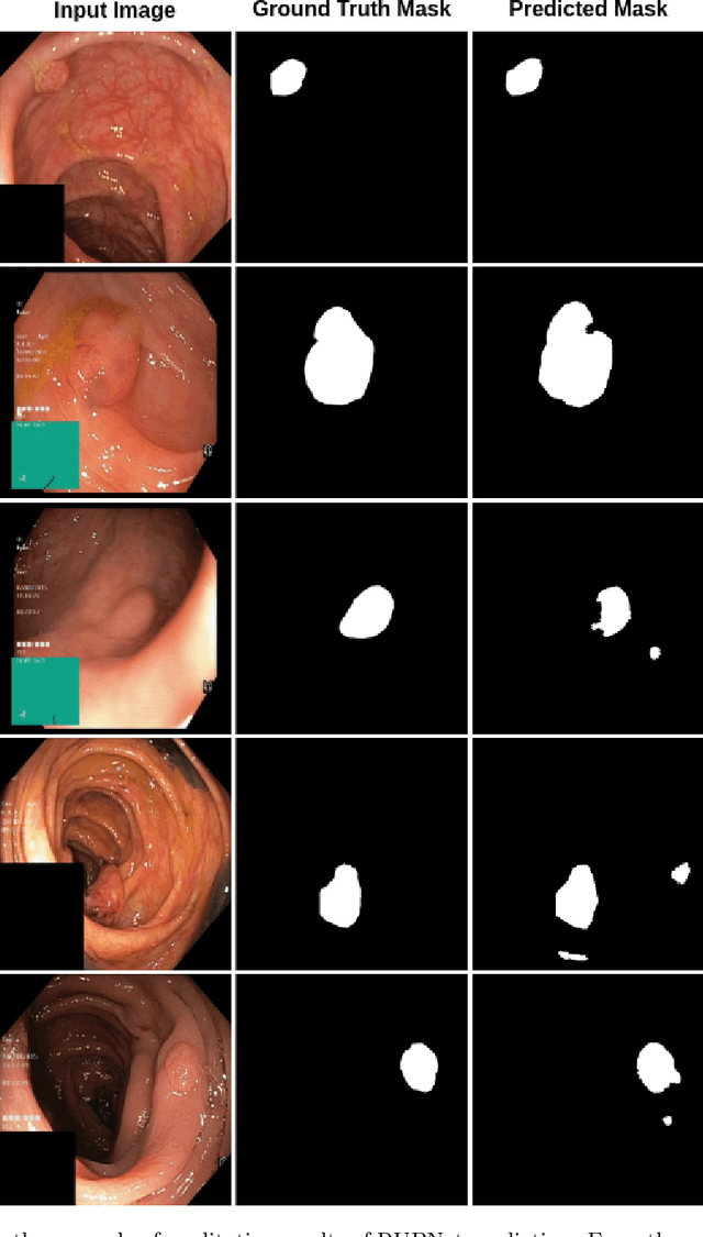 Figure 4 for RUPNet: Residual upsampling network for real-time polyp segmentation