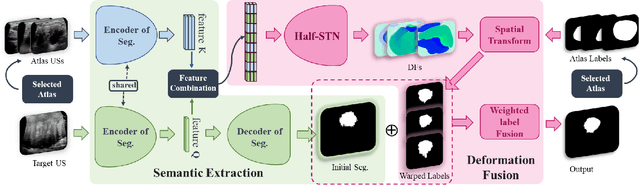 Figure 4 for Ultrasound Image Segmentation of Thyroid Nodule via Latent Semantic Feature Co-Registration