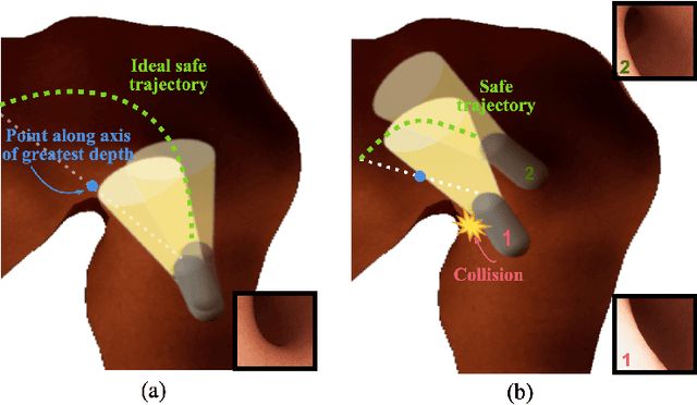 Figure 3 for Constrained Reinforcement Learning and Formal Verification for Safe Colonoscopy Navigation