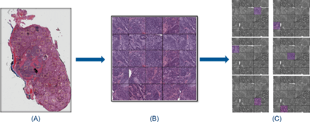 Figure 2 for Ranking Loss and Sequestering Learning for Reducing Image Search Bias in Histopathology