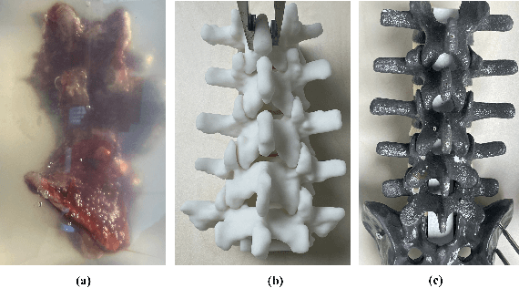 Figure 4 for Enabling Augmented Segmentation and Registration in Ultrasound-Guided Spinal Surgery via Realistic Ultrasound Synthesis from Diagnostic CT Volume