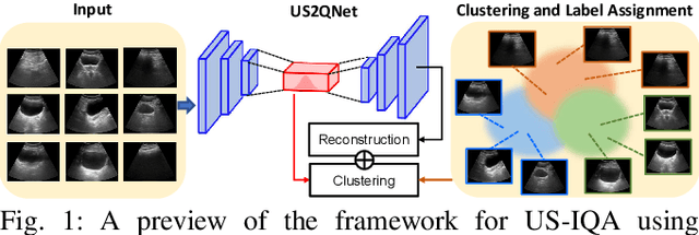 Figure 1 for Expert-Agnostic Ultrasound Image Quality Assessment using Deep Variational Clustering