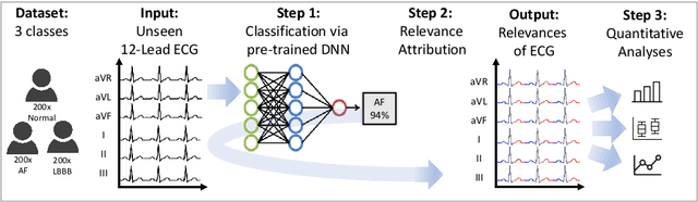 Figure 1 for Analysis of a Deep Learning Model for 12-Lead ECG Classification Reveals Learned Features Similar to Diagnostic Criteria