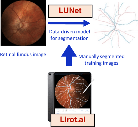 Figure 1 for LUNet: Deep Learning for the Segmentation of Arterioles and Venules in High Resolution Fundus Images