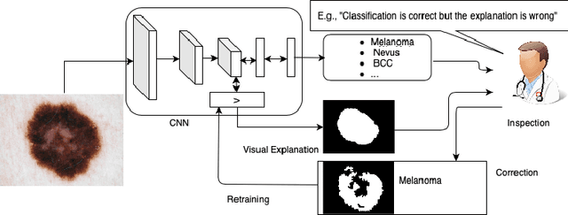 Figure 1 for Fine-tuning of explainable CNNs for skin lesion classification based on dermatologists' feedback towards increasing trust