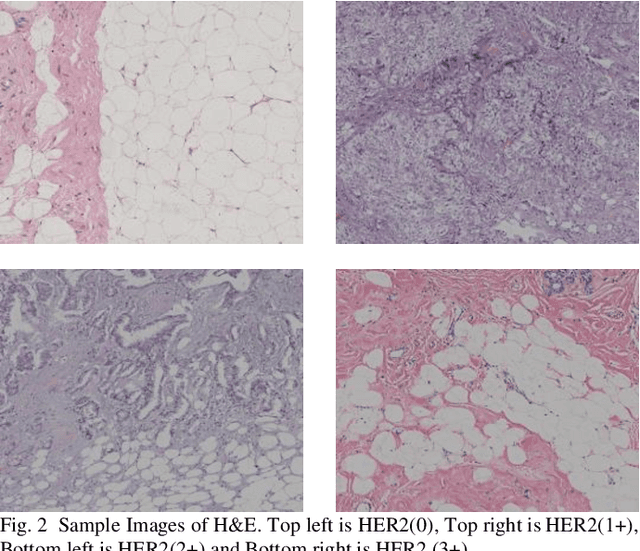 Figure 2 for convoHER2: A Deep Neural Network for Multi-Stage Classification of HER2 Breast Cancer