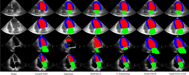 Figure 4 for MediViSTA-SAM: Zero-shot Medical Video Analysis with Spatio-temporal SAM Adaptation