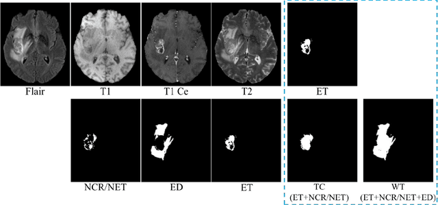 Figure 1 for A Radiomics-Incorporated Deep Ensemble Learning Model for Multi-Parametric MRI-based Glioma Segmentation