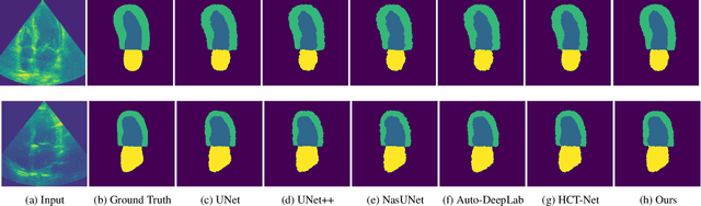 Figure 3 for SSHNN: Semi-Supervised Hybrid NAS Network for Echocardiographic Image Segmentation
