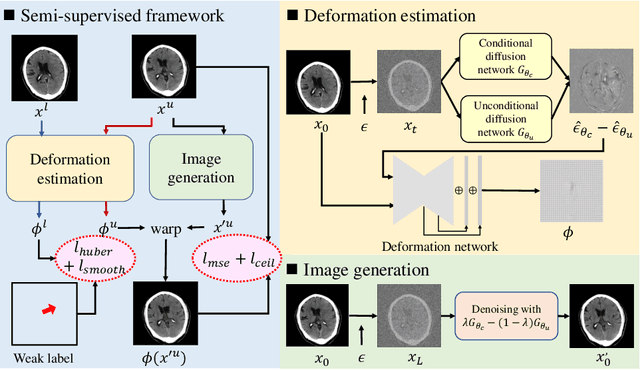 Figure 3 for Diffusion Model based Semi-supervised Learning on Brain Hemorrhage Images for Efficient Midline Shift Quantification
