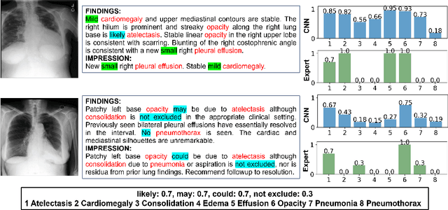 Figure 1 for Expert Uncertainty and Severity Aware Chest X-Ray Classification by Multi-Relationship Graph Learning