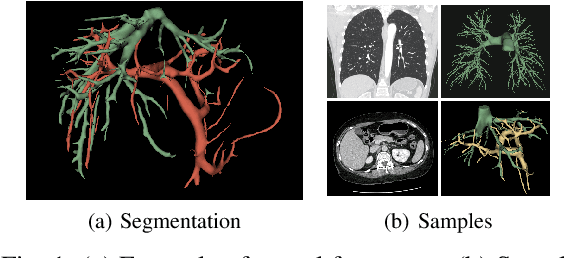 Figure 1 for The optimal connection model for blood vessels segmentation and the MEA-Net