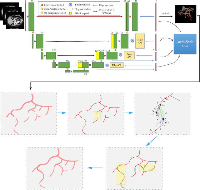 Figure 2 for The optimal connection model for blood vessels segmentation and the MEA-Net