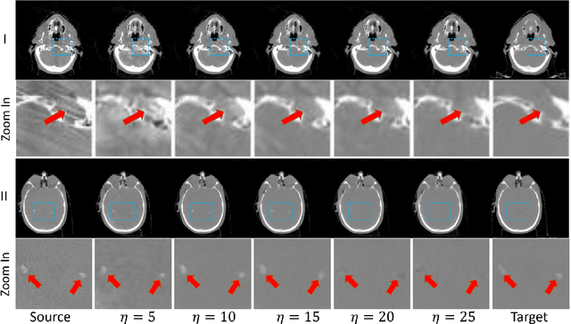 Figure 4 for Zero-shot Medical Image Translation via Frequency-Guided Diffusion Models