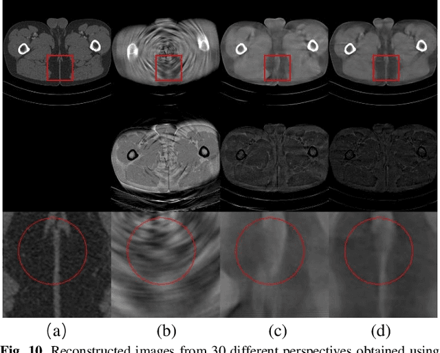 Figure 2 for MSDiff: Multi-Scale Diffusion Model for Ultra-Sparse View CT Reconstruction