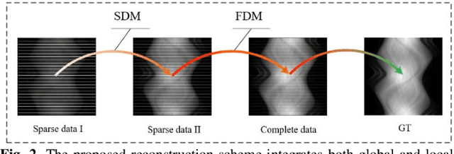Figure 3 for MSDiff: Multi-Scale Diffusion Model for Ultra-Sparse View CT Reconstruction