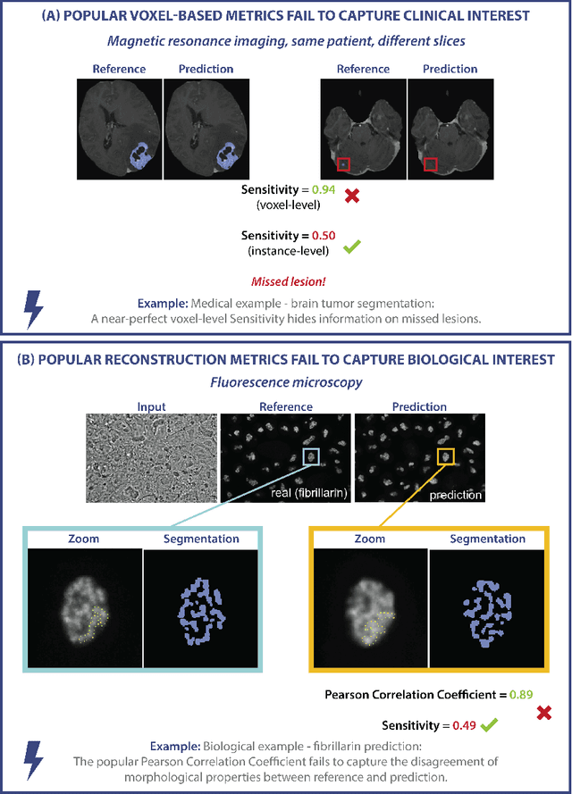 Figure 1 for Understanding metric-related pitfalls in image analysis validation