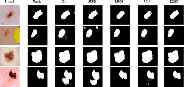 Figure 2 for U-Net-based Models for Skin Lesion Segmentation: More Attention and Augmentation