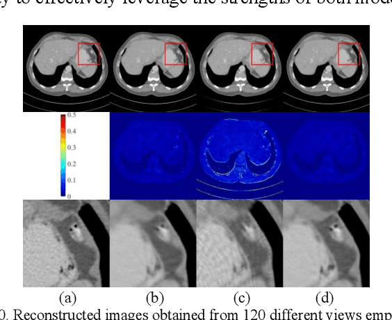 Figure 2 for Stage-by-stage Wavelet Optimization Refinement Diffusion Model for Sparse-View CT Reconstruction