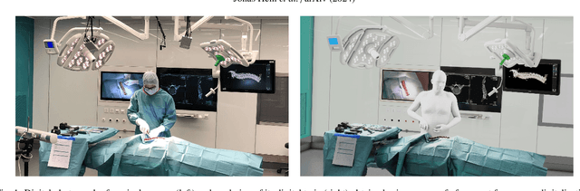 Figure 1 for Creating a Digital Twin of Spinal Surgery: A Proof of Concept