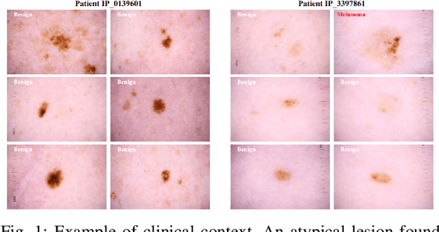 Figure 1 for CIFF-Net: Contextual Image Feature Fusion for Melanoma Diagnosis