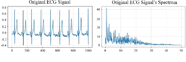 Figure 3 for Transfer Knowledge from Natural Language to Electrocardiography: Can We Detect Cardiovascular Disease Through Language Models?