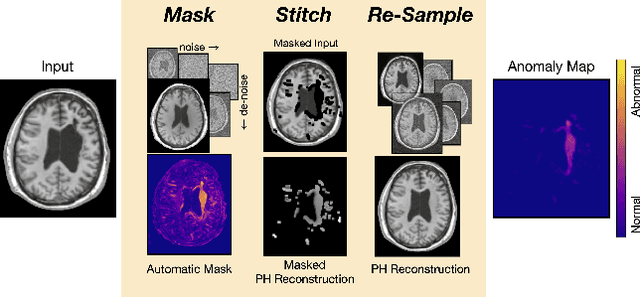 Figure 1 for Mask, Stitch, and Re-Sample: Enhancing Robustness and Generalizability in Anomaly Detection through Automatic Diffusion Models