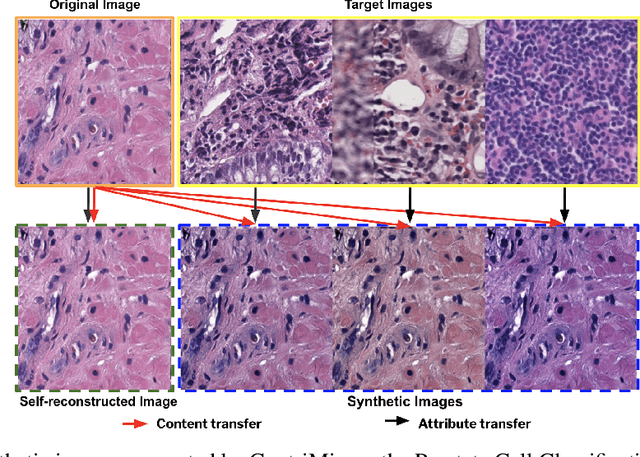 Figure 3 for ContriMix: Unsupervised disentanglement of content and attribute for domain generalization in microscopy image analysis
