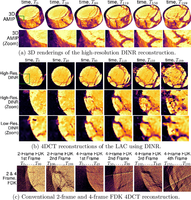 Figure 4 for Distributed Stochastic Optimization of a Neural Representation Network for Time-Space Tomography Reconstruction