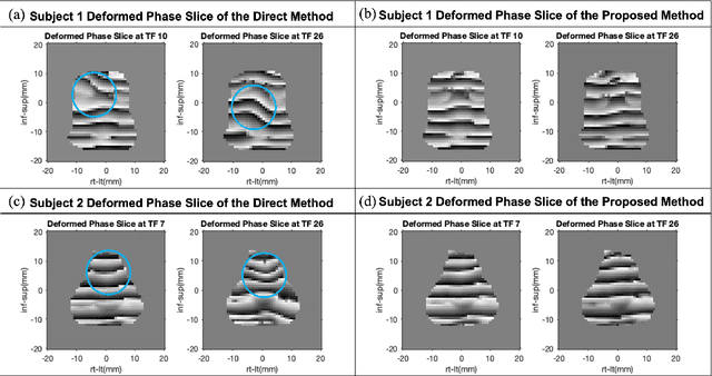 Figure 3 for New starting point registration method for tagged MRI tongue motion estimation