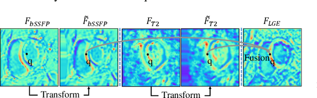 Figure 3 for Aligning Multi-Sequence CMR Towards Fully Automated Myocardial Pathology Segmentation