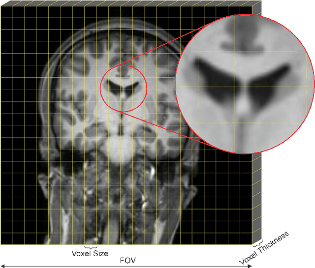 Figure 1 for Automated computed tomography and magnetic resonance imaging segmentation using deep learning: a beginner's guide