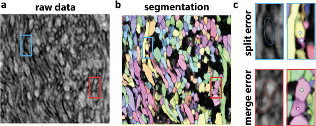 Figure 2 for The XPRESS Challenge: Xray Projectomic Reconstruction -- Extracting Segmentation with Skeletons