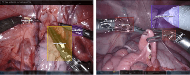 Figure 4 for Surgical tool classification and localization: results and methods from the MICCAI 2022 SurgToolLoc challenge