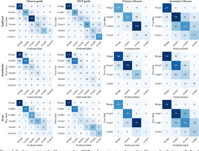 Figure 3 for Weakly Supervised Joint Whole-Slide Segmentation and Classification in Prostate Cancer