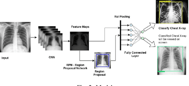 Figure 3 for Lung Diseases Image Segmentation using Faster R-CNNs