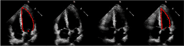 Figure 1 for UniLVSeg: Unified Left Ventricular Segmentation with Sparsely Annotated Echocardiogram Videos through Self-Supervised Temporal Masking and Weakly Supervised Training