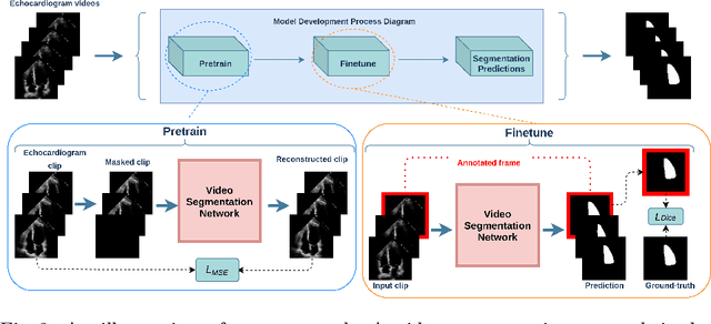 Figure 3 for UniLVSeg: Unified Left Ventricular Segmentation with Sparsely Annotated Echocardiogram Videos through Self-Supervised Temporal Masking and Weakly Supervised Training