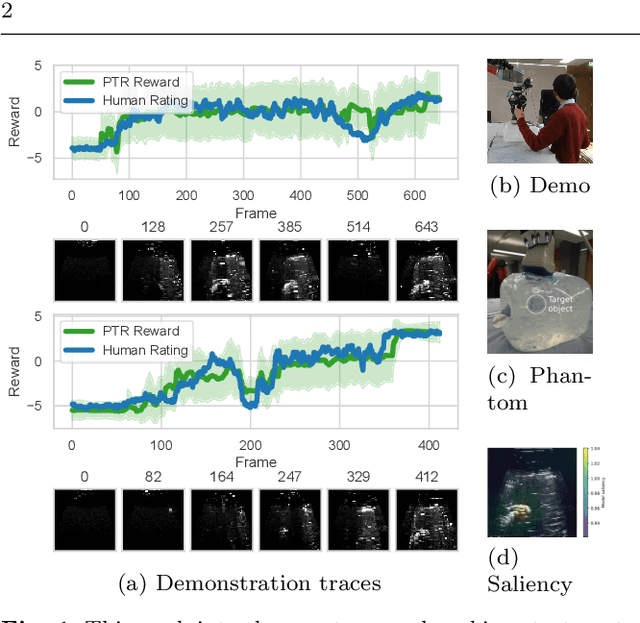 Figure 1 for Learning robotic ultrasound scanning using probabilistic temporal ranking