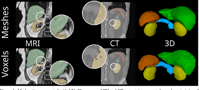 Figure 1 for Meshes Meet Voxels: Abdominal Organ Segmentation via Diffeomorphic Deformations