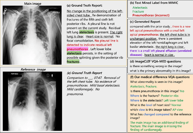 Figure 1 for Expert Knowledge-Aware Image Difference Graph Representation Learning for Difference-Aware Medical Visual Question Answering