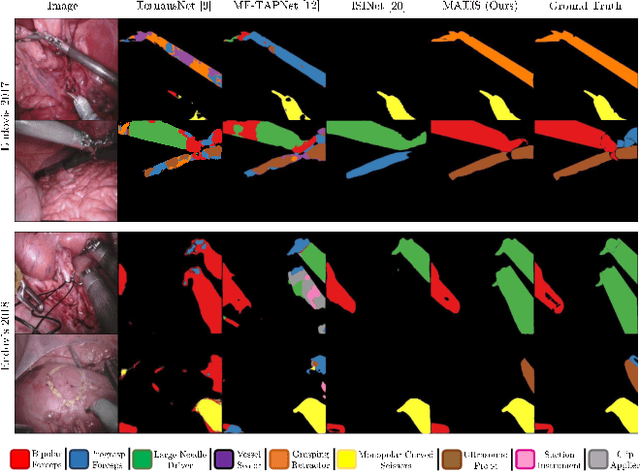 Figure 1 for MATIS: Masked-Attention Transformers for Surgical Instrument Segmentation