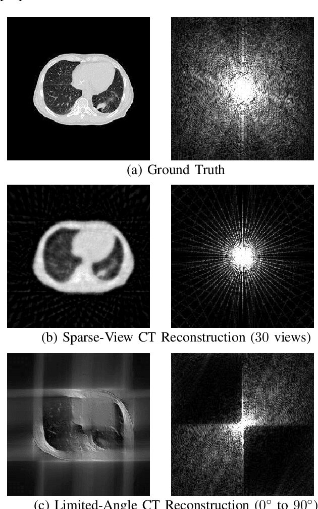 Figure 1 for RBP-DIP: High-Quality CT Reconstruction Using an Untrained Neural Network with Residual Back Projection and Deep Image Prior