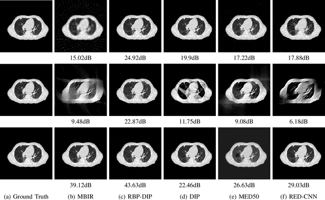 Figure 2 for RBP-DIP: High-Quality CT Reconstruction Using an Untrained Neural Network with Residual Back Projection and Deep Image Prior