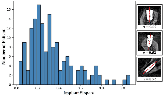 Figure 2 for TCSloT: Text Guided 3D Context and Slope Aware Triple Network for Dental Implant Position Prediction