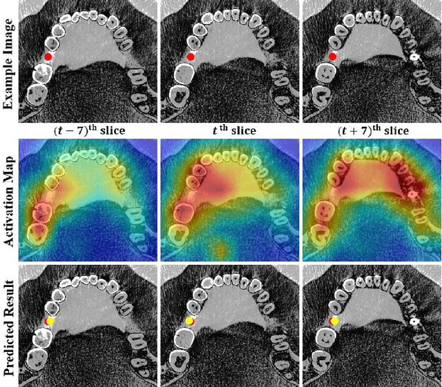 Figure 4 for TCSloT: Text Guided 3D Context and Slope Aware Triple Network for Dental Implant Position Prediction