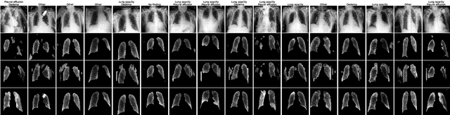 Figure 2 for Analysing the effectiveness of a generative model for semi-supervised medical image segmentation