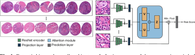 Figure 1 for Attention-based Multiple Instance Learning for Survival Prediction on Lung Cancer Tissue Microarrays