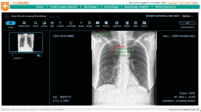 Figure 4 for A general-purpose AI assistant embedded in an open-source radiology information system