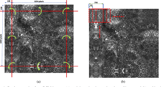 Figure 1 for Enhancing Diagnosis through AI-driven Analysis of Reflectance Confocal Microscopy